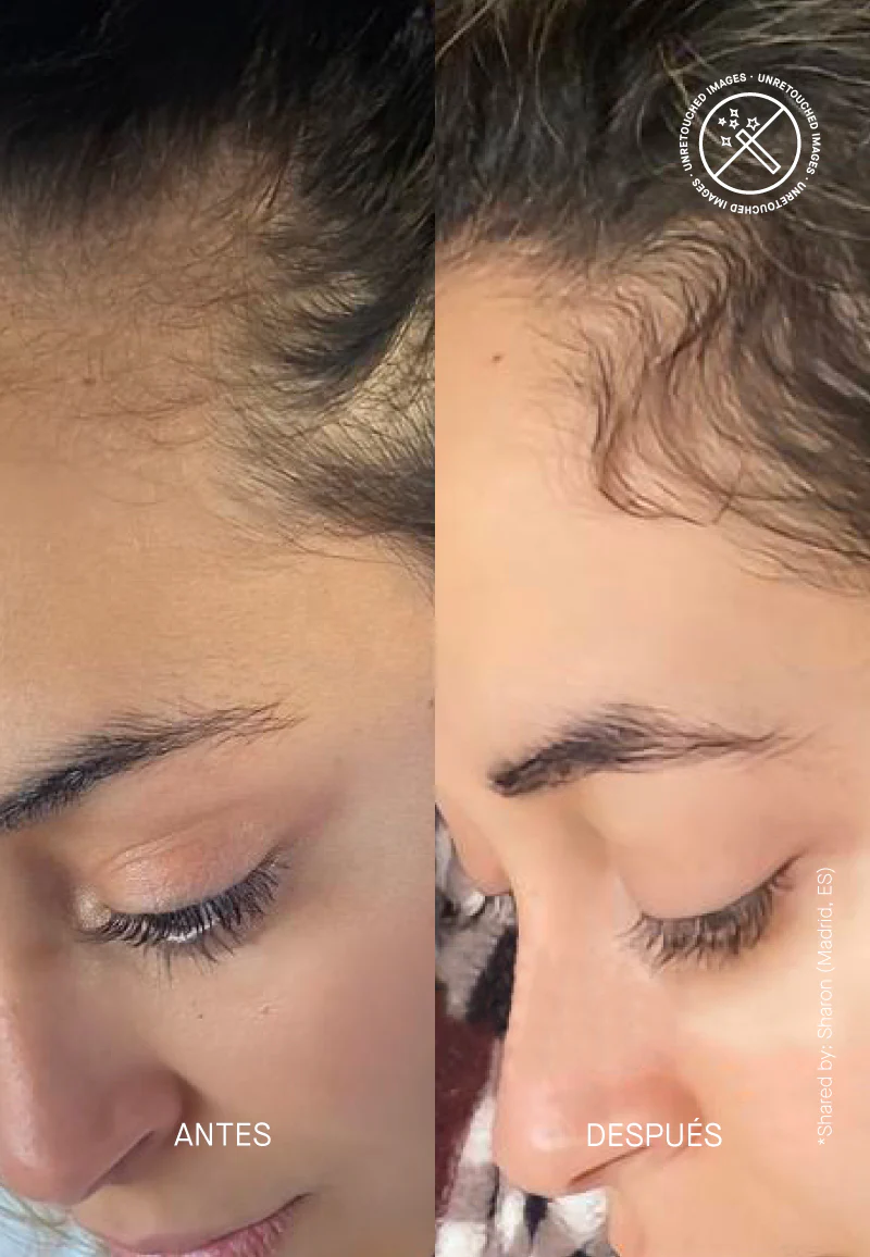 Hair Density Scalp Treatment - Image 9