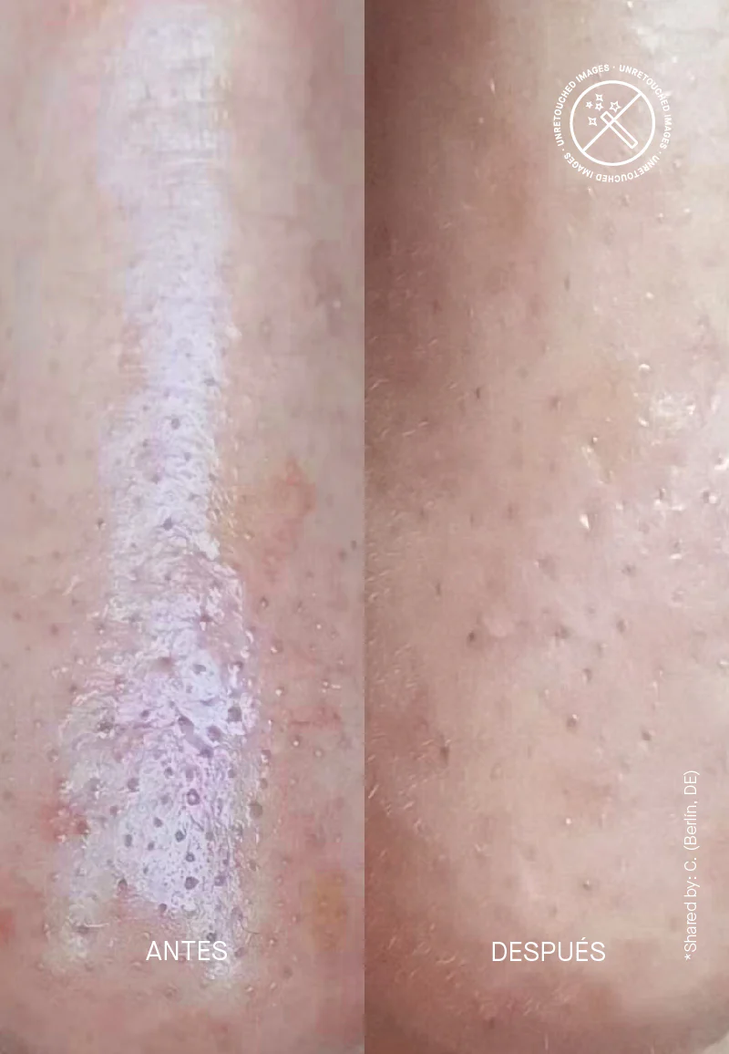 Zitproof® Nose - Image 8